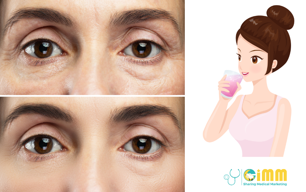 3_Điều_bí_mật_về_Collagen_sẽ_nguyên_nhân_bạn_Già