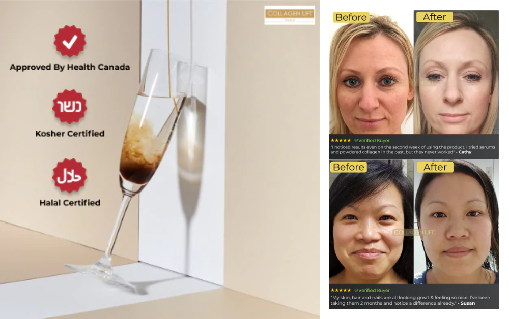 Collagen_Lift_Paris