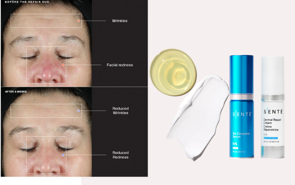 Retinol_Thế_hệ_mới_0.1%