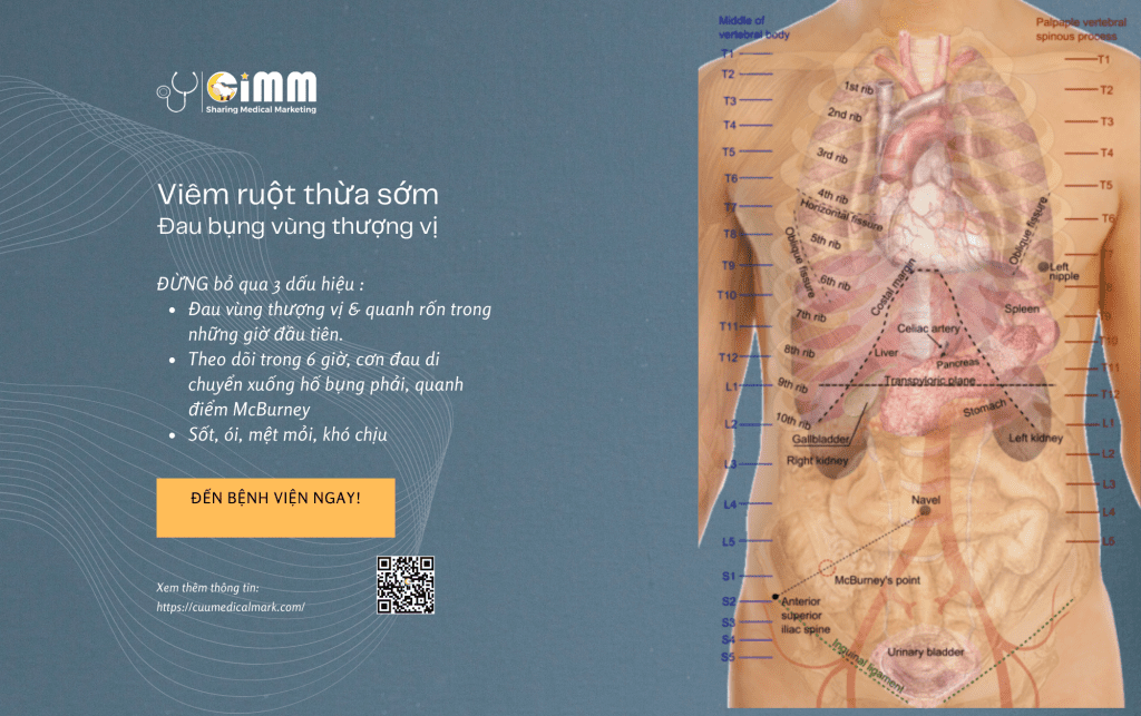 Epigastric_Pain_Viem_Ruot_Thua_Dau_Bung_Vung_Thuong_Vi_dau_an_McBurney